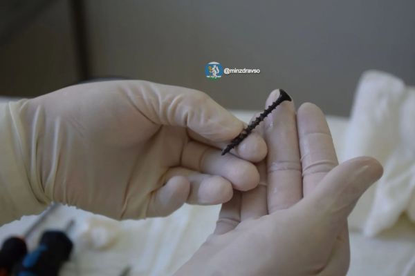 Уральские врачи сохранили зрение двухлетнему мальчику, в глазницу которого вошел саморез